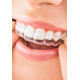 Aligner Steps